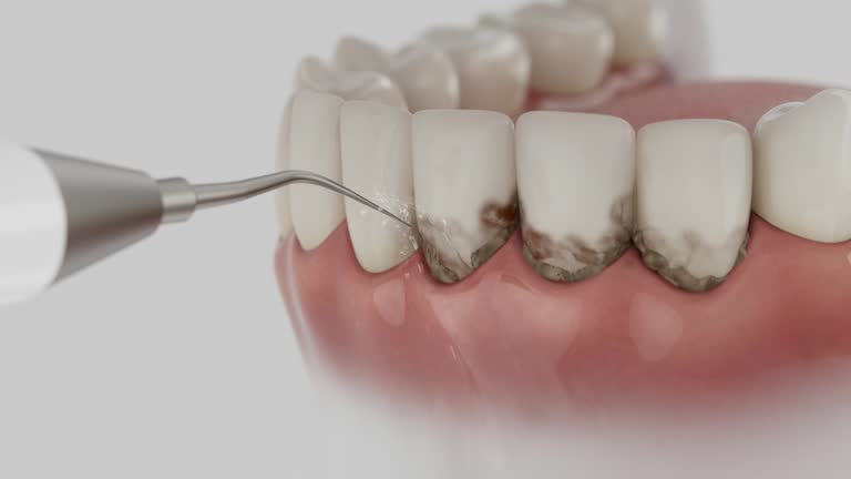 Trusted Invisalign Clear Aligners service in Gettysburg, PA - Dentist Open Now